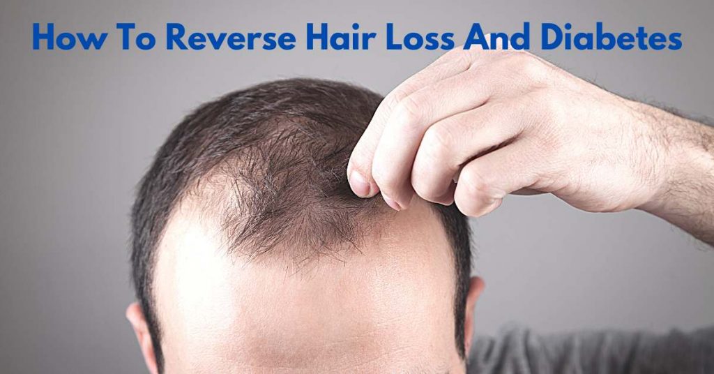 How To Reverse Hair Loss And Diabetes